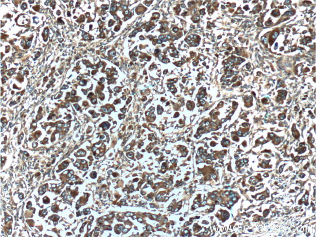 TCP1 Antibody in Immunohistochemistry (Paraffin) (IHC (P))