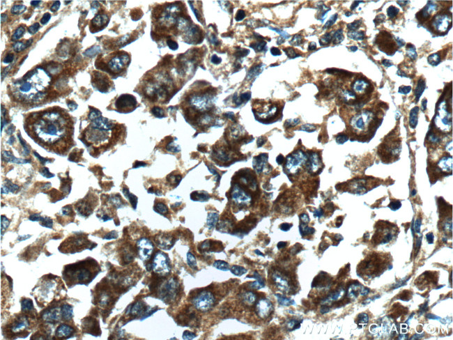 TCP1 Antibody in Immunohistochemistry (Paraffin) (IHC (P))