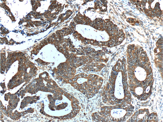 TCP1 Antibody in Immunohistochemistry (Paraffin) (IHC (P))