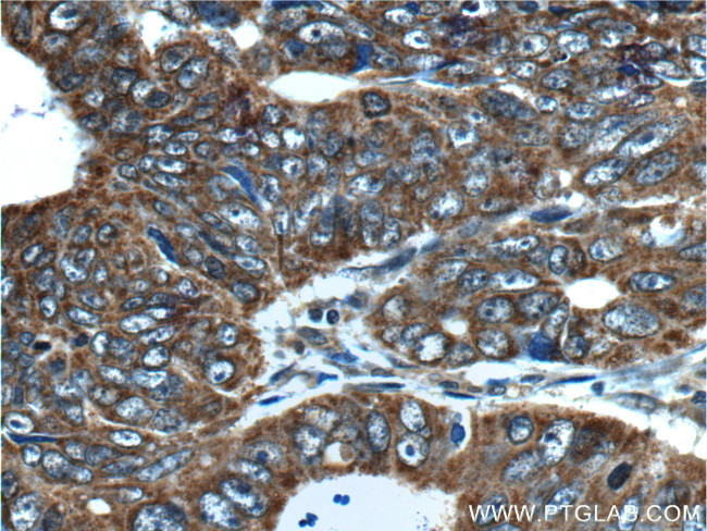 TCP1 Antibody in Immunohistochemistry (Paraffin) (IHC (P))