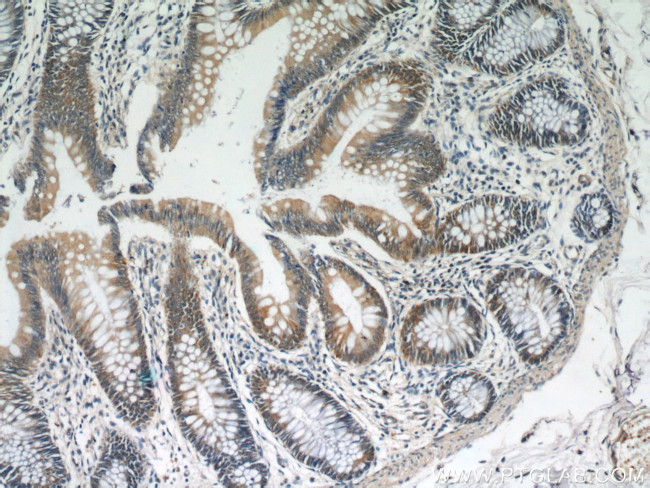 TCP1 Antibody in Immunohistochemistry (Paraffin) (IHC (P))