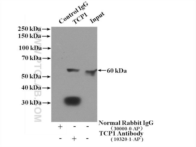 TCP1 Antibody in Immunoprecipitation (IP)