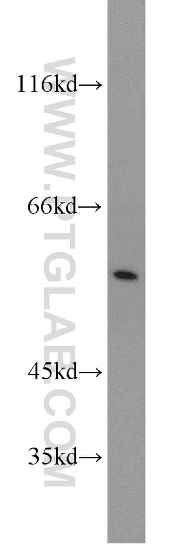 TCP1 Antibody in Western Blot (WB)