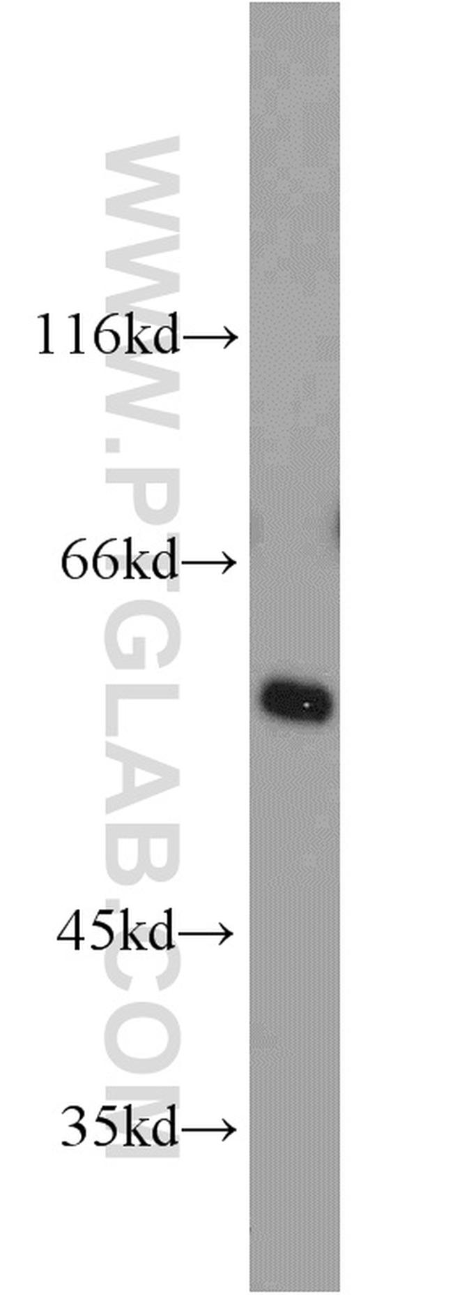 TCP1 Antibody in Western Blot (WB)