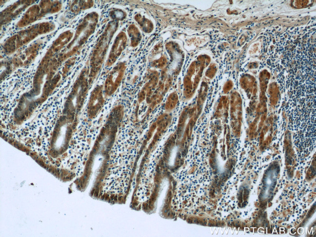 PPP2R4 Antibody in Immunohistochemistry (Paraffin) (IHC (P))