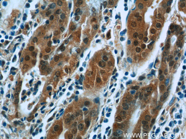 PPP2R4 Antibody in Immunohistochemistry (Paraffin) (IHC (P))