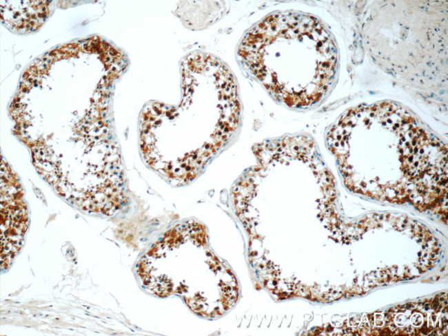 PPP2R4 Antibody in Immunohistochemistry (Paraffin) (IHC (P))