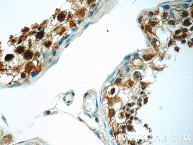 PPP2R4 Antibody in Immunohistochemistry (Paraffin) (IHC (P))