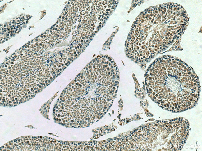 PPP2R4 Antibody in Immunohistochemistry (Paraffin) (IHC (P))