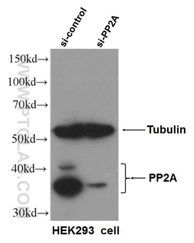 PPP2R4 Antibody in Western Blot (WB)