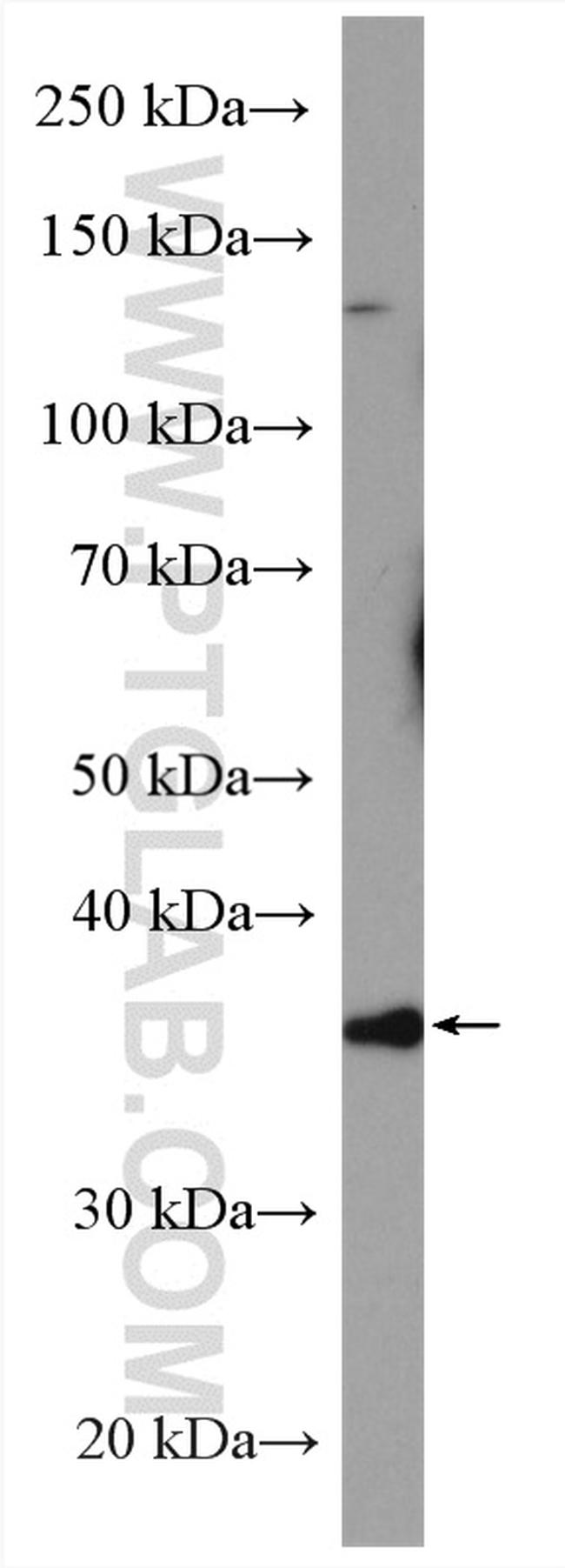 PPP2R4 Antibody in Western Blot (WB)