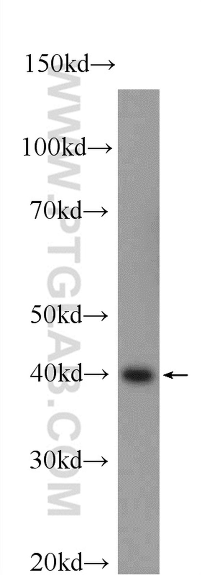 PPP2R4 Antibody in Western Blot (WB)