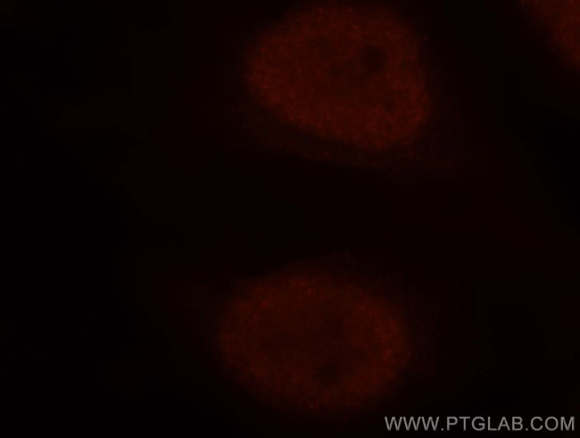 NUDT21 Antibody in Immunocytochemistry (ICC/IF)