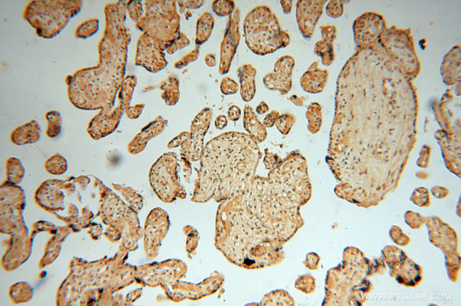 NUDT21 Antibody in Immunohistochemistry (Paraffin) (IHC (P))