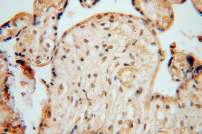 NUDT21 Antibody in Immunohistochemistry (Paraffin) (IHC (P))