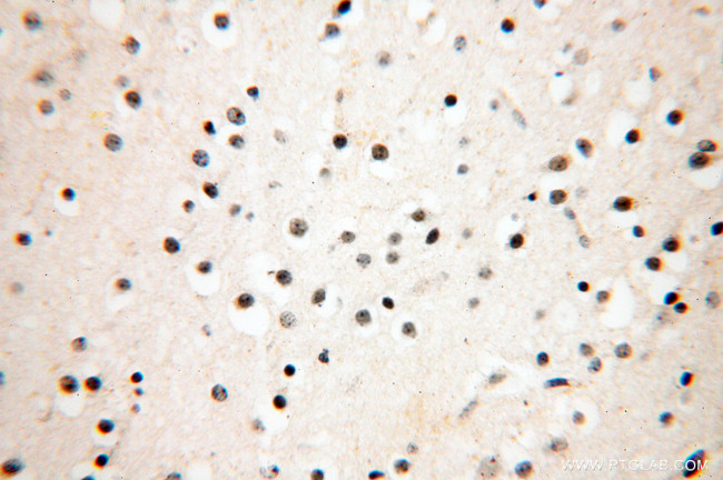 NUDT21 Antibody in Immunohistochemistry (Paraffin) (IHC (P))