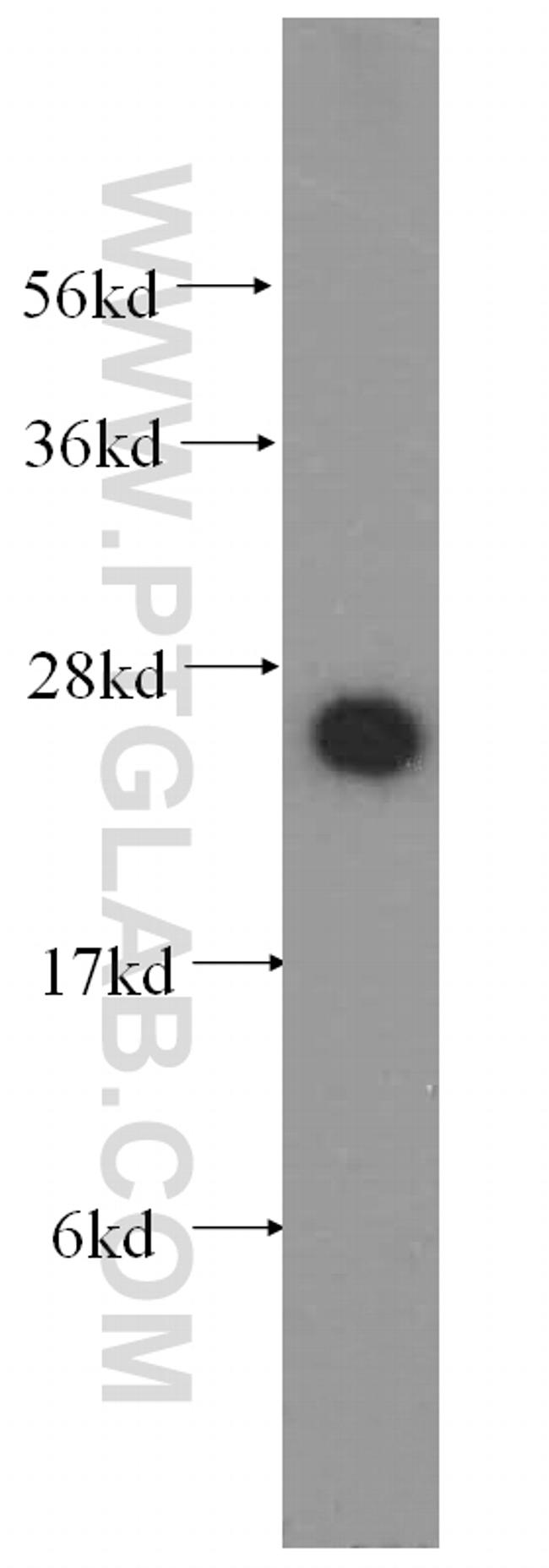 NUDT21 Antibody in Western Blot (WB)