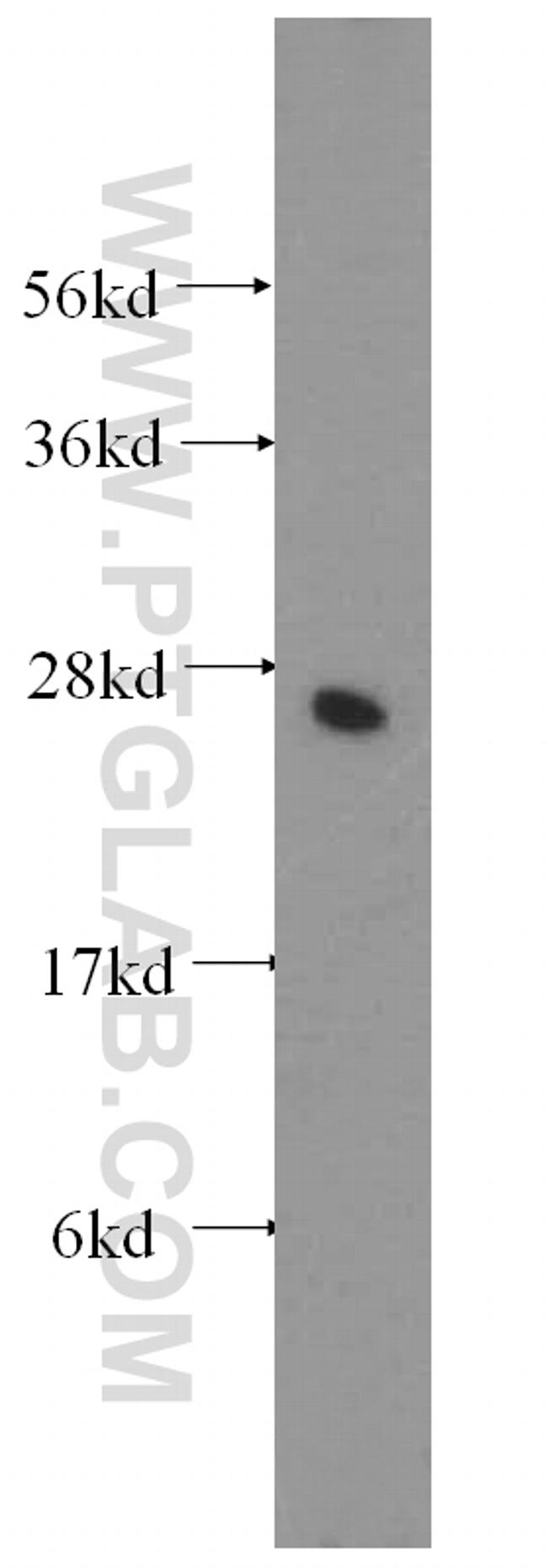 NUDT21 Antibody in Western Blot (WB)