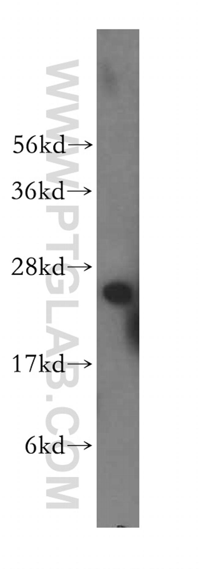 NUDT21 Antibody in Western Blot (WB)