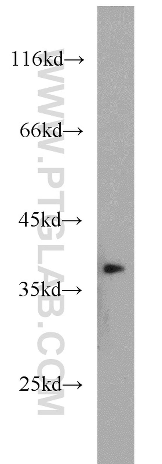 APEX1 Antibody in Western Blot (WB)