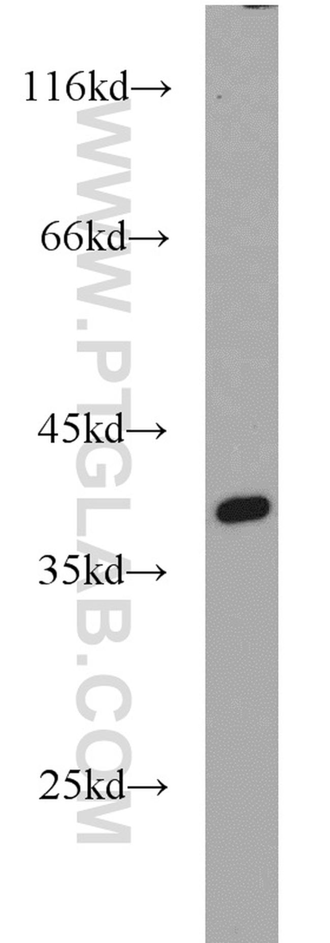 APEX1 Antibody in Western Blot (WB)