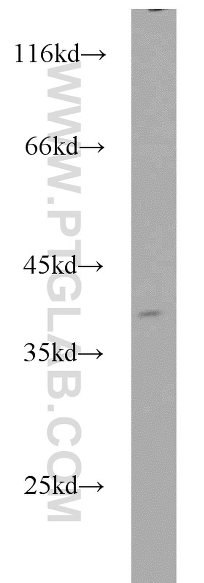 APEX1 Antibody in Western Blot (WB)