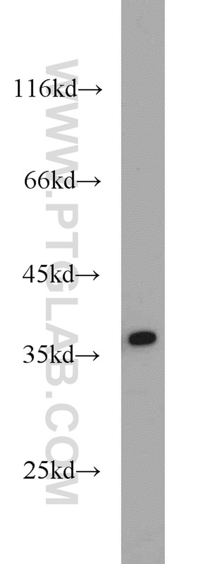 APEX1 Antibody in Western Blot (WB)