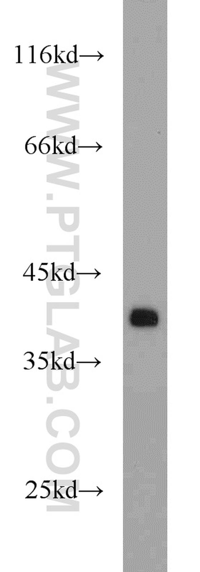 APEX1 Antibody in Western Blot (WB)