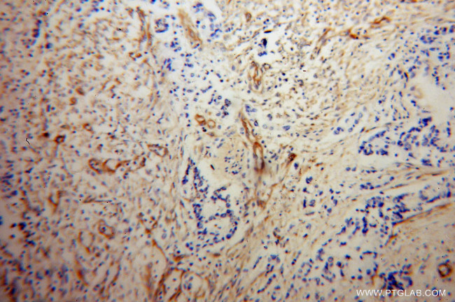 MYL12B Antibody in Immunohistochemistry (Paraffin) (IHC (P))