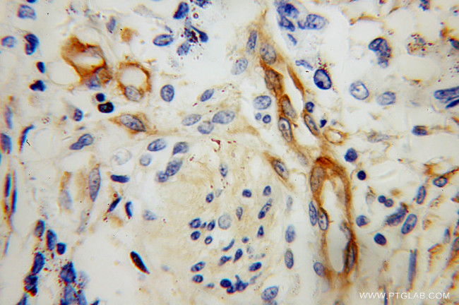 MYL12B Antibody in Immunohistochemistry (Paraffin) (IHC (P))