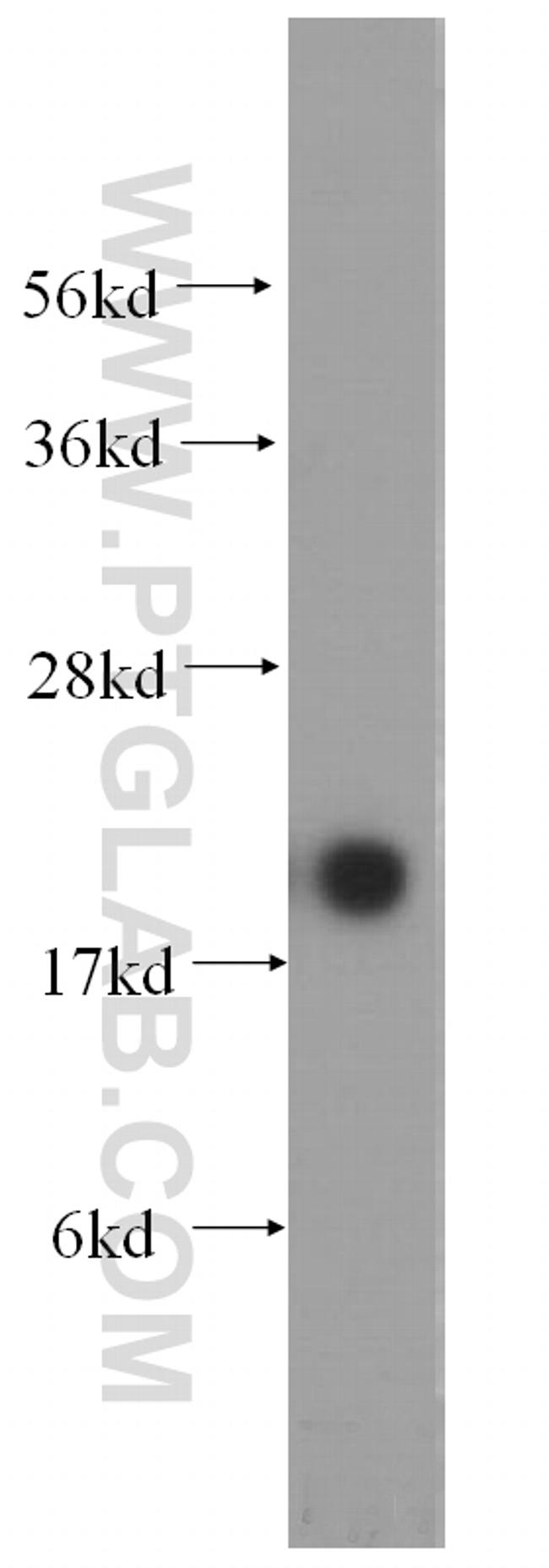 MYL12B Antibody in Western Blot (WB)