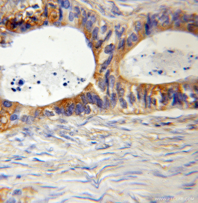 MYL12B Antibody in Immunohistochemistry (Paraffin) (IHC (P))