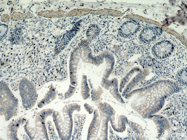 TRIM32 Antibody in Immunohistochemistry (Paraffin) (IHC (P))