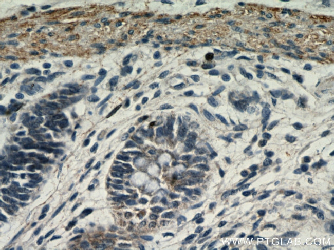 TRIM32 Antibody in Immunohistochemistry (Paraffin) (IHC (P))