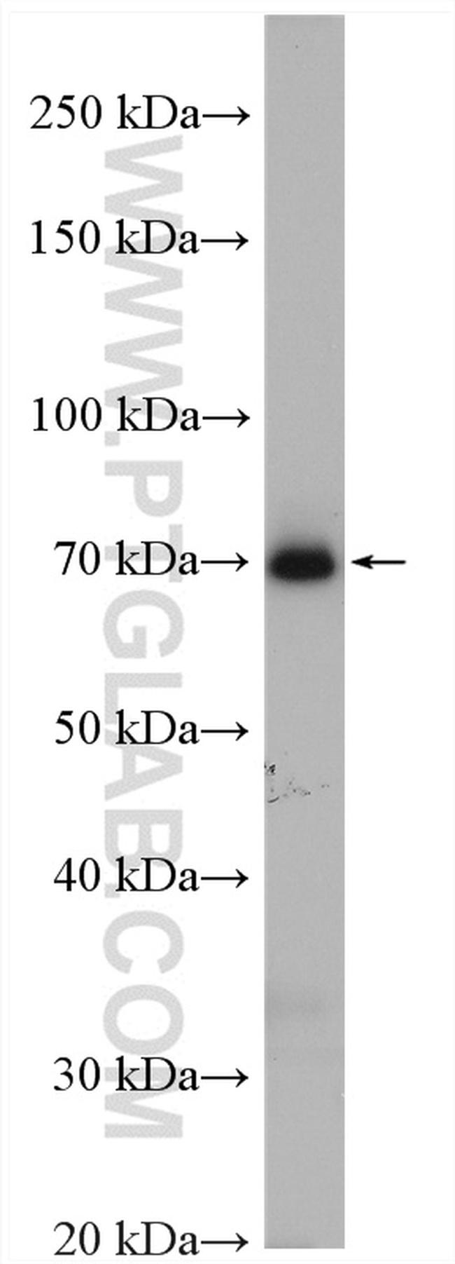 NXF1 Antibody in Western Blot (WB)