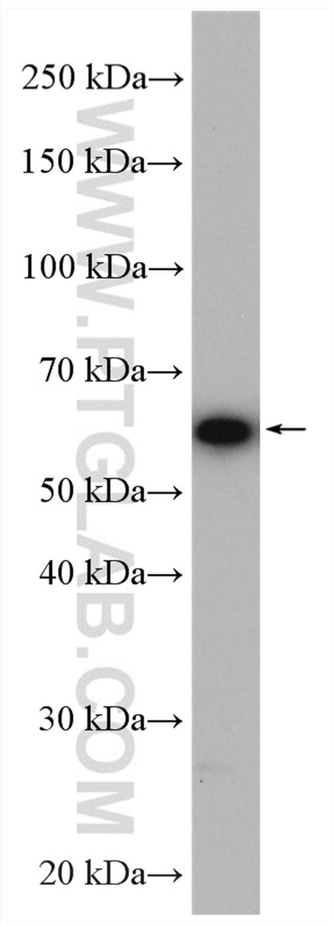 NXF1 Antibody in Western Blot (WB)