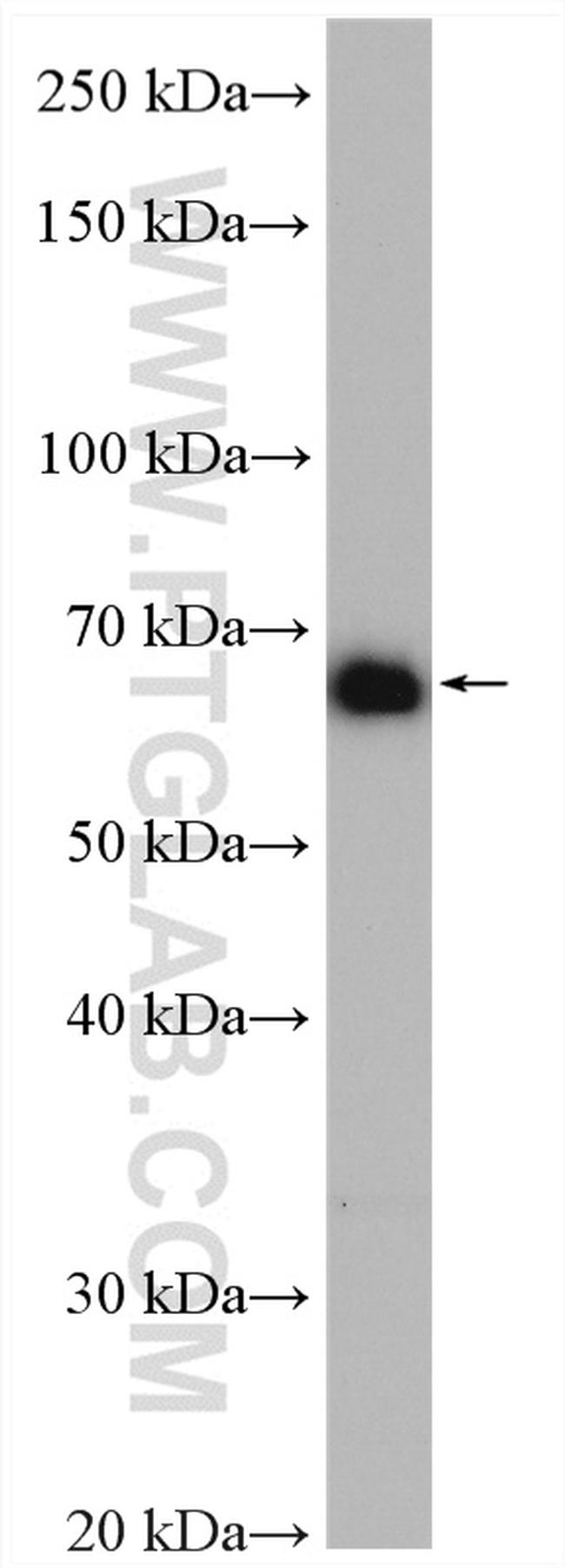 NXF1 Antibody in Western Blot (WB)