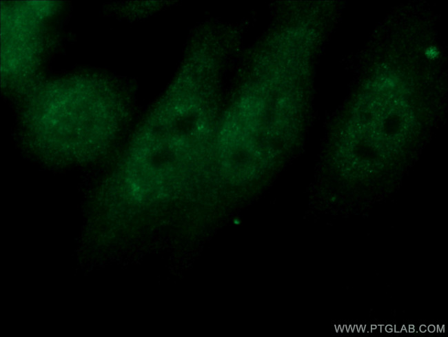 NXF1 Antibody in Immunocytochemistry (ICC/IF)