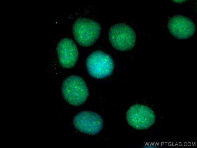 SUMO1 Antibody in Immunocytochemistry (ICC/IF)