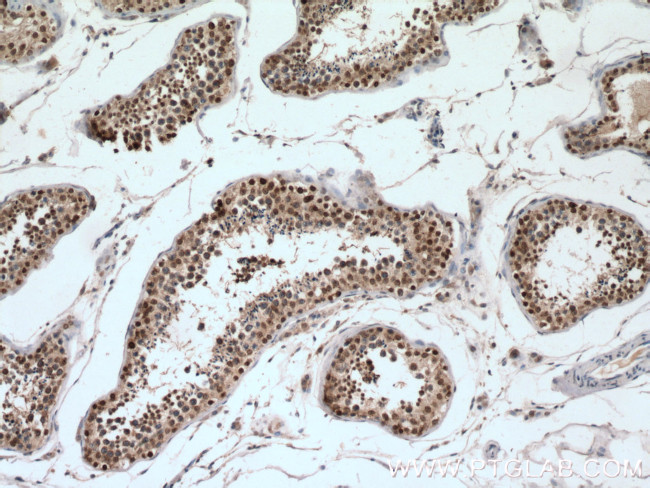 SUMO1 Antibody in Immunohistochemistry (Paraffin) (IHC (P))