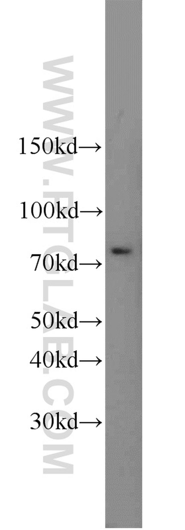 SUMO1 Antibody in Western Blot (WB)