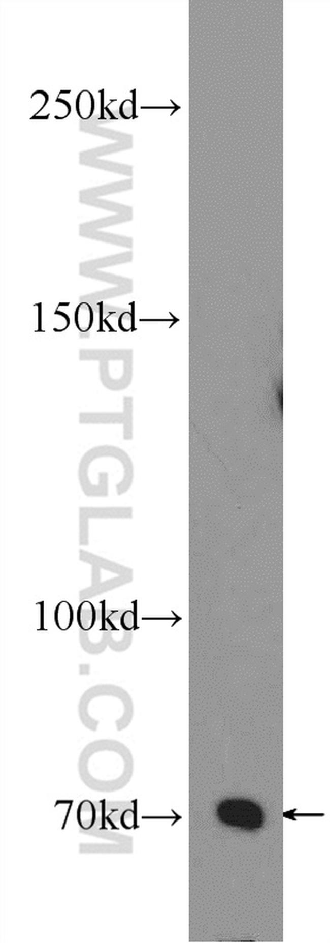 SUMO1 Antibody in Western Blot (WB)