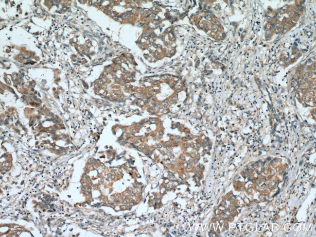 RARA Antibody in Immunohistochemistry (Paraffin) (IHC (P))