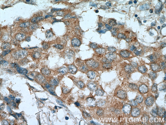 RARA Antibody in Immunohistochemistry (Paraffin) (IHC (P))