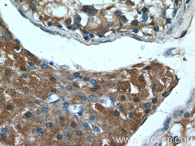 RARA Antibody in Immunohistochemistry (Paraffin) (IHC (P))