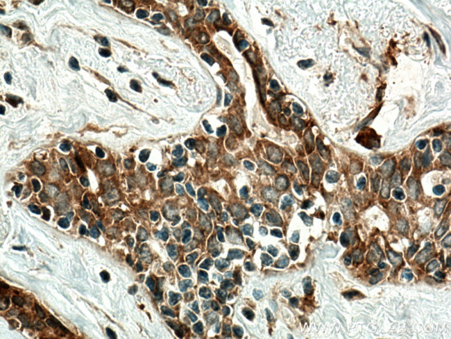 RARA Antibody in Immunohistochemistry (Paraffin) (IHC (P))