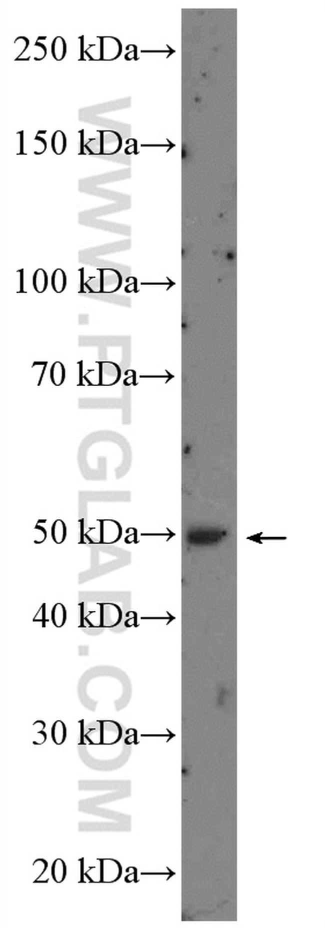 RARA Antibody in Western Blot (WB)