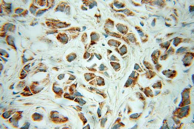 CHRNA3 Antibody in Immunohistochemistry (Paraffin) (IHC (P))