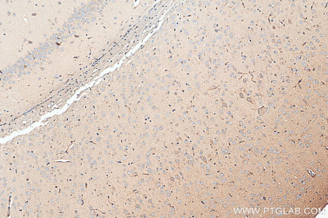 CHRNA3 Antibody in Immunohistochemistry (Paraffin) (IHC (P))