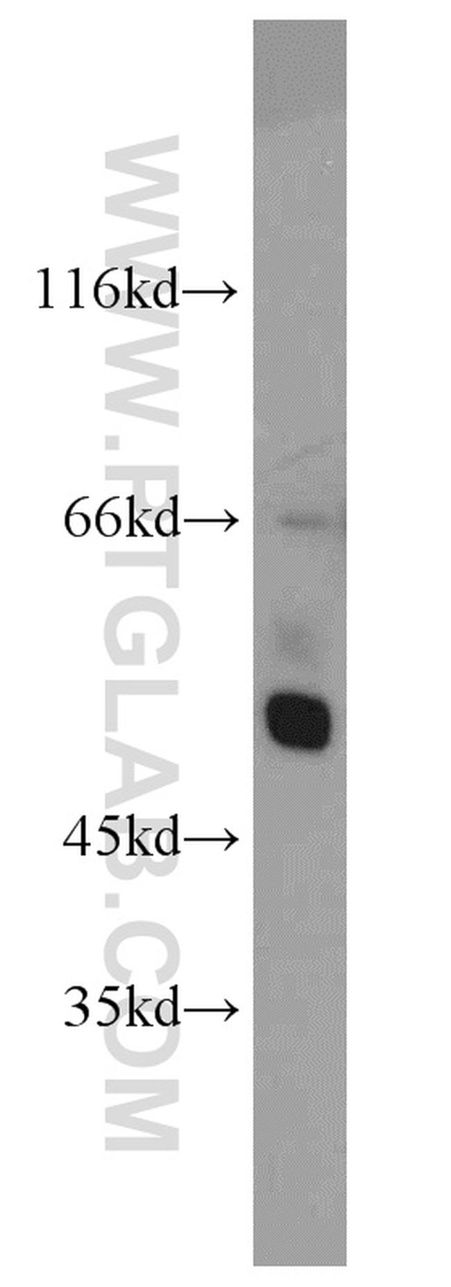 CHRNA3 Antibody in Western Blot (WB)